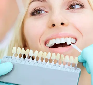 Los mejores tratamientos de estética dental en Barcelona